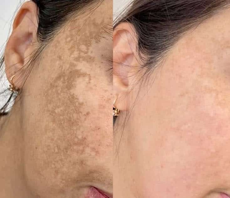 Texture Caviale risultati viso
